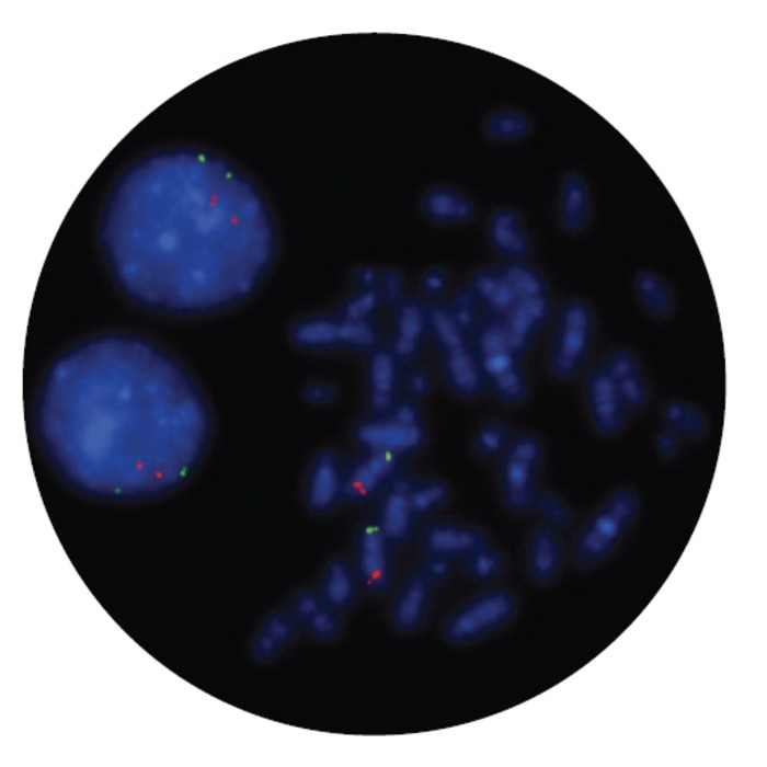 Fluorescence in situ hybridization (FISH) microscope image of the FDA-cleared CytoCell Del(5q) Deletion probe.