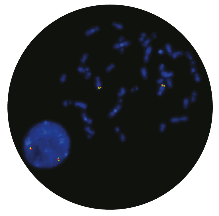 Fluorescence in situ hybridization (FISH) microscope image of the CytoCell PDGFRB Breakapart probe.