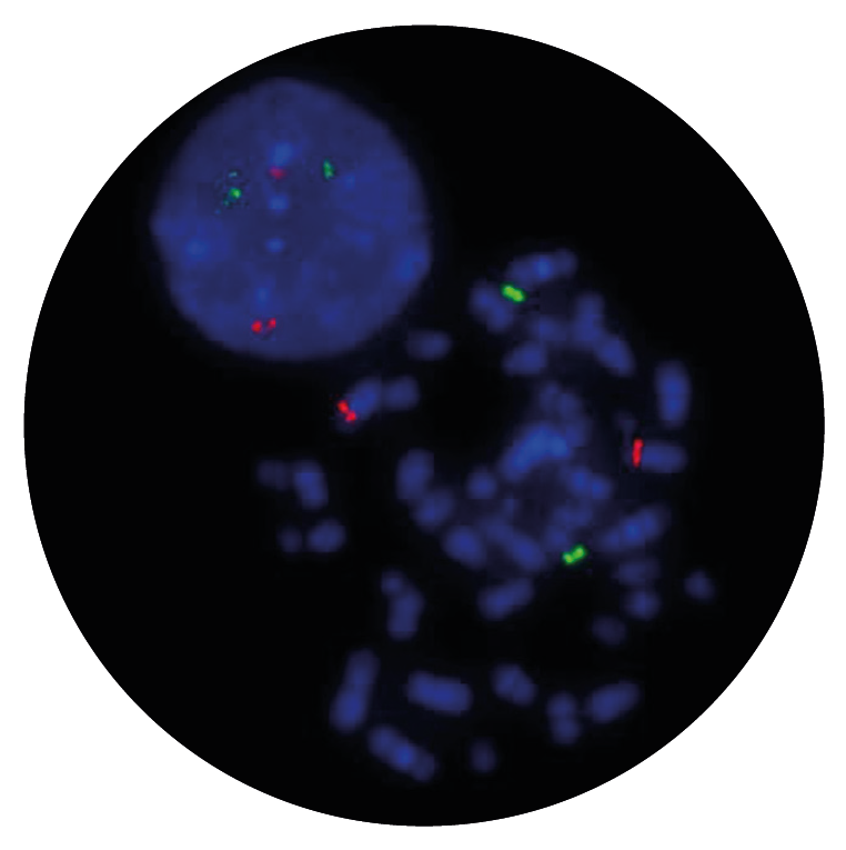 Fluorescence in situ hybridisation (FISH) microscope image of the CytoCell IGH/CCND3 Plus Translocation, Dual Fusion probe.
