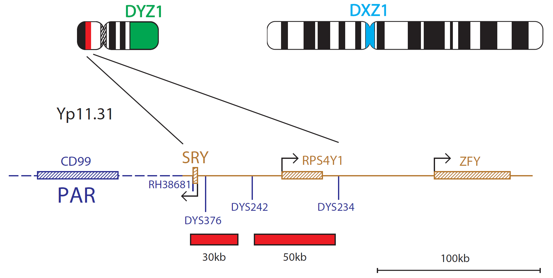 Fluorescence in situ hybridisation (FISH) chromosome map showing a probe targeting the SRY (sex-determining region Y) gene.