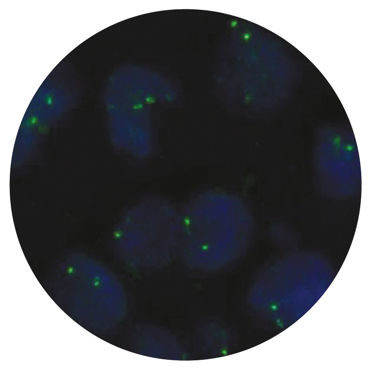 Fluorescence in situ hybridization (FISH) microscope image of the CytoCell ROS1-GOPC (FIG) Proximal probe.
