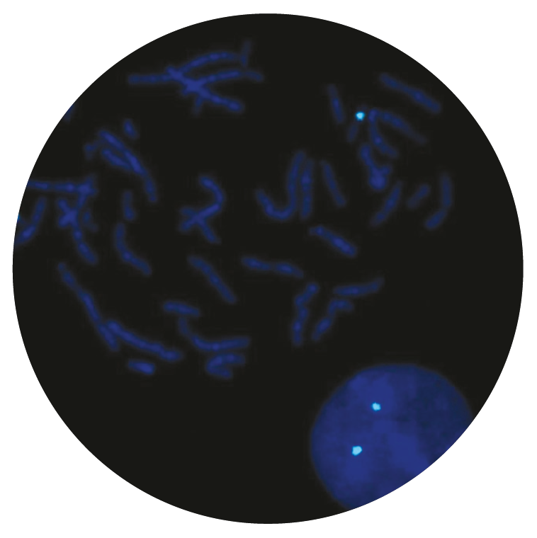 Fluorescence in situ hybridization (FISH) microscope image of the CytoCell Centromere 17 Probe Aqua.