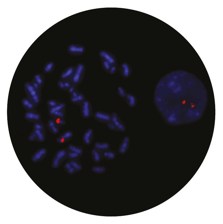 Fluorescence in situ hybridization (FISH) microscope image of the CytoCell MLLT1 probe.