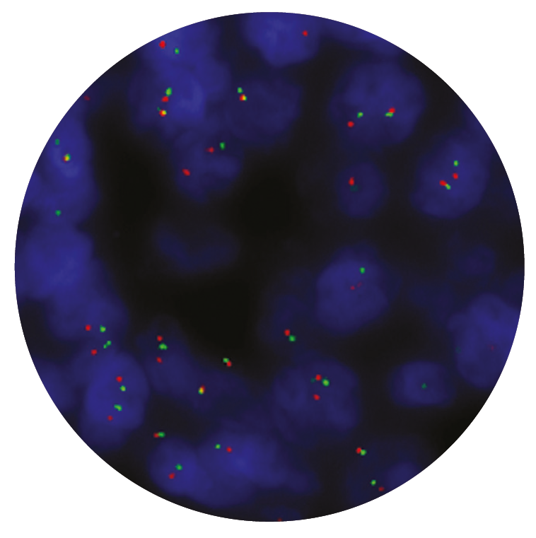 Fluorescence in situ hybridization (FISH) microscope image of the CytoCell IGK Breakapart probe.