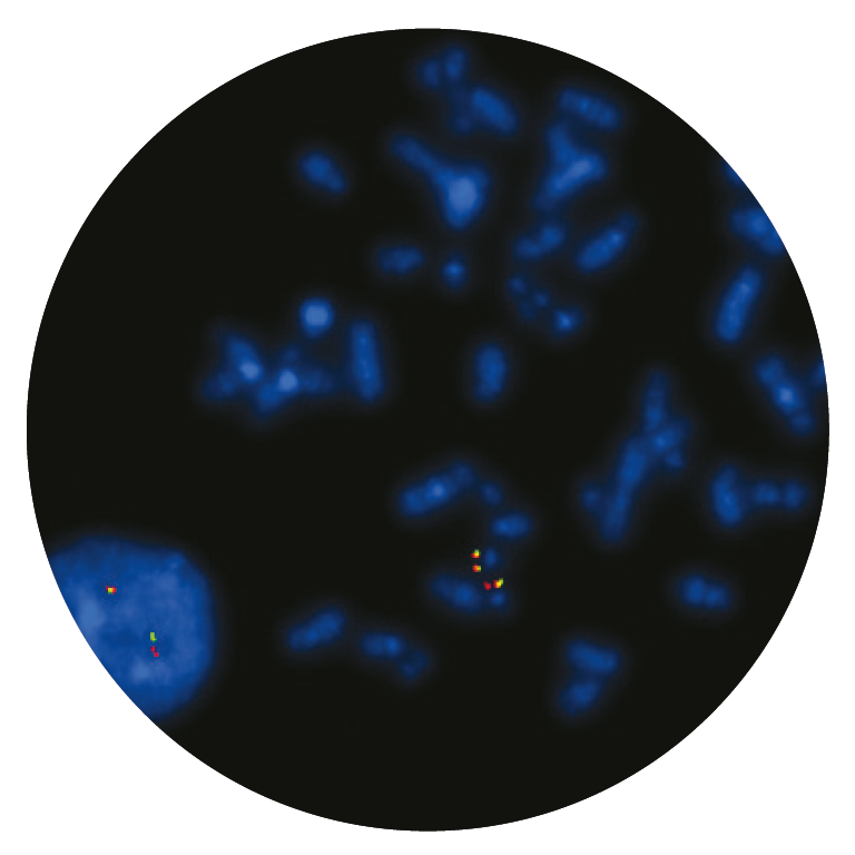 Fluorescence in situ hybridisation (FISH) microscope image of the CytoCell E2A (TCF3) Breakapart probe.