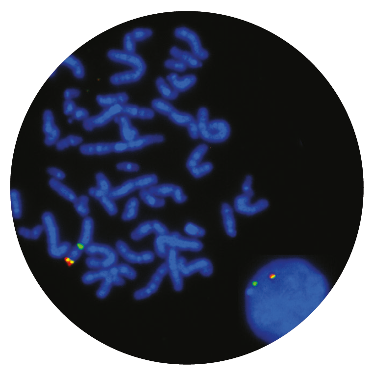 Fluorescence in situ hybridisation (FISH) microscope image of the CytoCell Kallmann (KAL1)/STS Probe Combination.