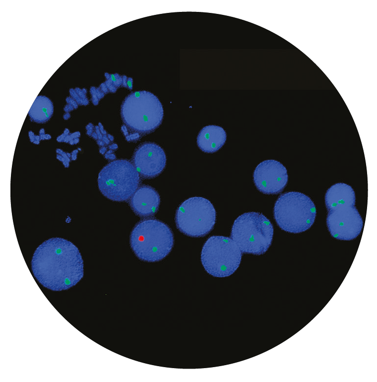 Fluorescence in situ hybridization (FISH) microscope image of the CytoCell Dual Labelled Satellite probe sets.