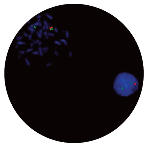 Fluorescence in situ hybridisation (FISH) microscope image of the CytoCell DiGeorge/VCFS TUPLE1 and 22q13.3 Deletion probe.