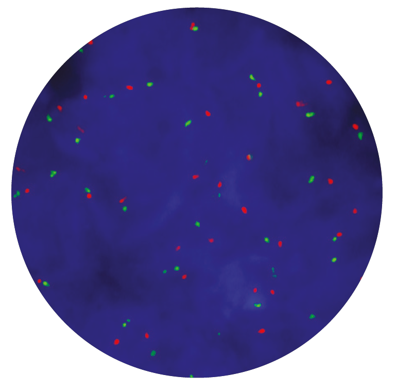 Fluorescence in situ hybridization (FISH) microscope image of the CytoCell C-MET (MET) Amplification probe.