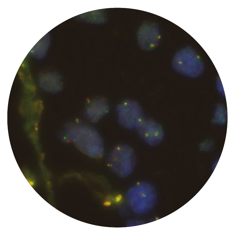Fluorescence in situ hybridisation (FISH) microscope image of the CytoCell ROS1 Plus Breakapart probe.