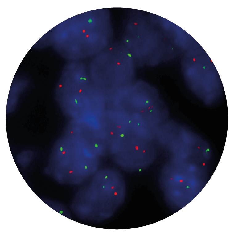 Fluorescence in situ hybridization (FISH) microscope image of the CytoCell P53 (TP53) Deletion probe.