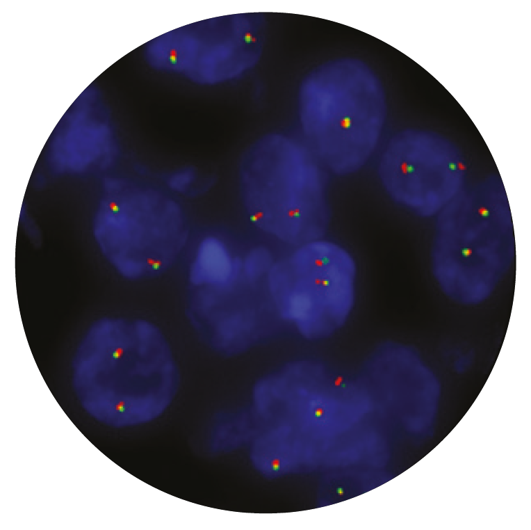 Fluorescence in situ hybridization (FISH) microscope image of the CytoCell ALK Breakapart probe.