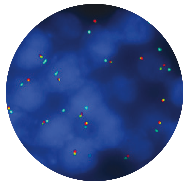 Fluorescence in situ hybridisation (FISH) microscope image of the CytoCell FGFR1 Breakapart/Amplification probe.