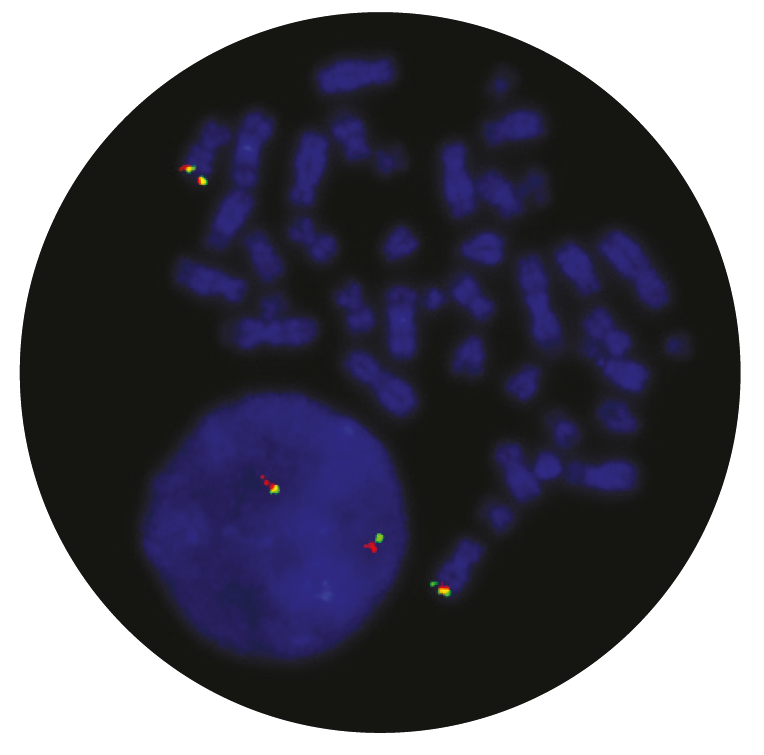 Fluorescence in situ hybridization (FISH) microscope image of the CytoCell TCRB (TRB) Breakapart probe.