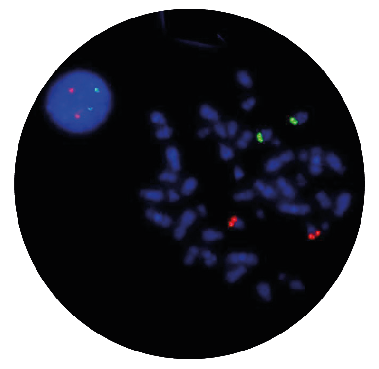 Fluorescence in situ hybridisation (FISH) microscope image of the CytoCell IGH/MAF Plus v2 Translocation, Dual Fusion probe.