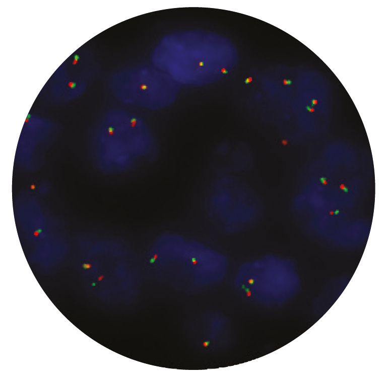 Fluorescence in situ hybridization (FISH) microscope image of the CytoCell TMPRSS2 Breakapart probe.