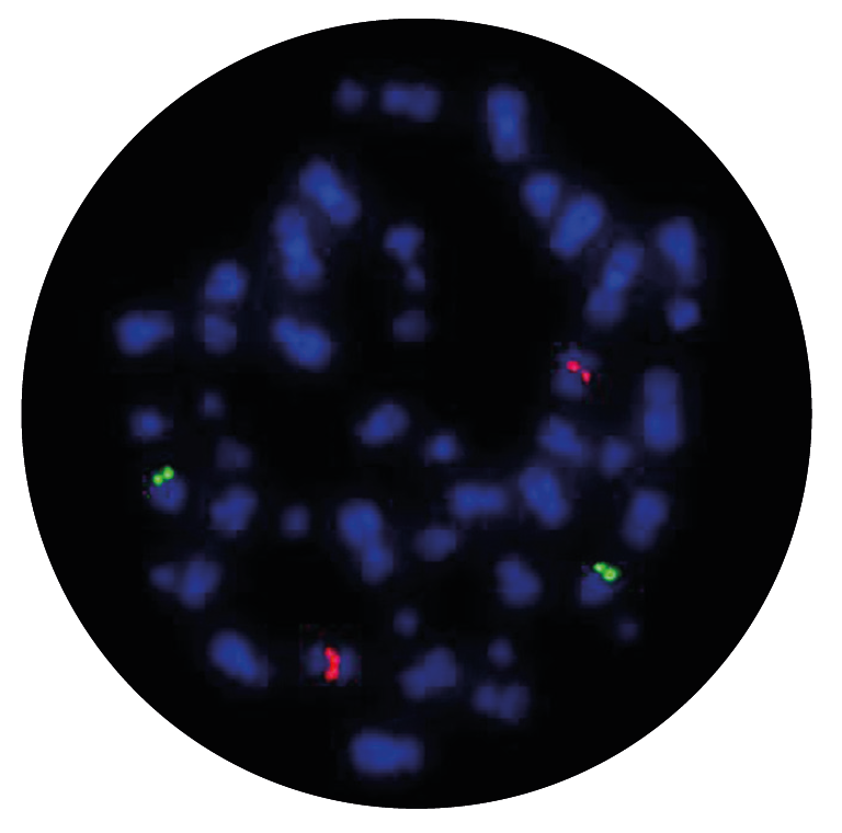 Fluorescence in situ hybridisation (FISH) microscope image of the CytoCell IGH/MYEOV Plus Translocation, Dual Fusion probe.
