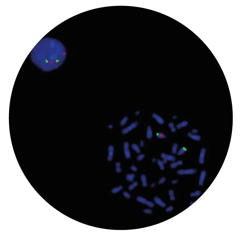 Fluorescence in situ hybridisation (FISH) microscope image of the CytoCell D13S319 Plus Deletion probe.
