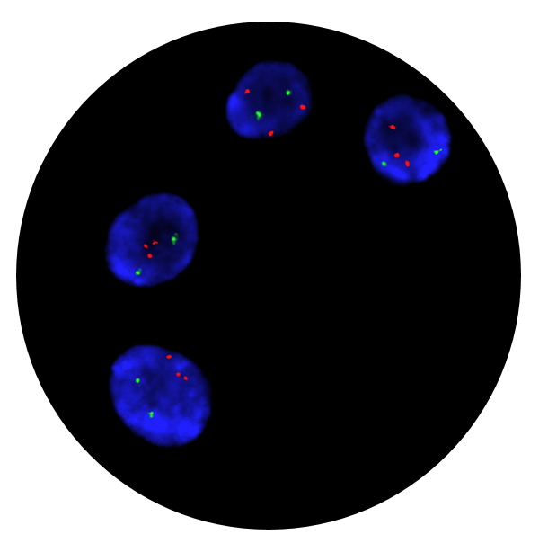Fluorescence in situ hybridisation (FISH) microscope image of the CytoCell Prenatal 13 and 21 Enumeration probe.
