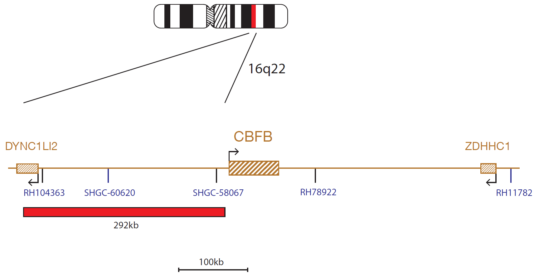 Fluorescence in situ hybridization (FISH) chromosome map showing a probe targeting the CBFB gene.