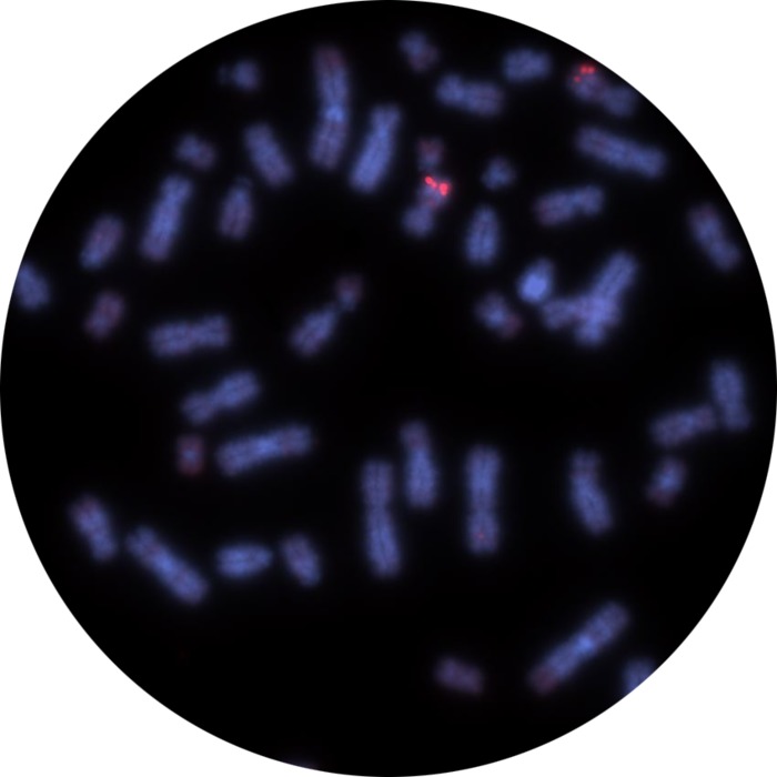 Fluorescence in situ hybridization (FISH) microscope image of the CytoCell MLL (KMT2A) Distal Probe Red.