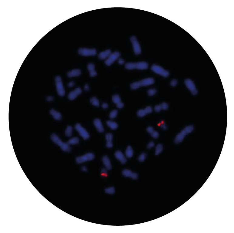 Fluorescence in situ hybridization (FISH) microscope image of the CytoCell MPO Probe Red.