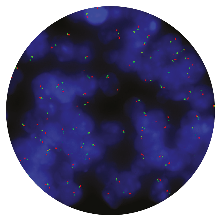 Fluorescence in situ hybridization (FISH) microscope image of the CytoCell EGFR Amplification probe.