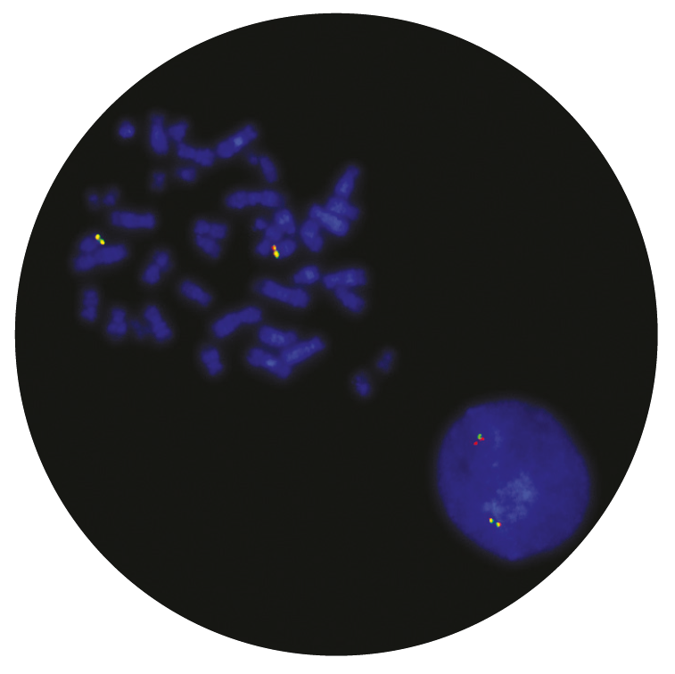 Fluorescence in situ hybridization (FISH) microscope image of the CytoCell TCL1 Breakapart probe.