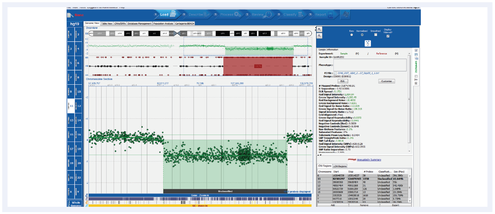 aCGH software data showing a CLL research sample run on a CytoSure Cancer +SNP array with a deletion and corresponding LOH.