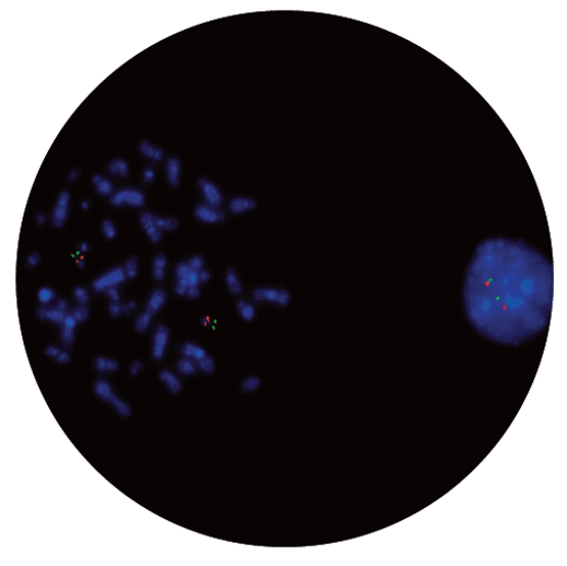 Fluorescence in situ hybridisation (FISH) microscope image of the CytoCell DiGeorge/TBX1 and 22q13.3 Deletion probe.