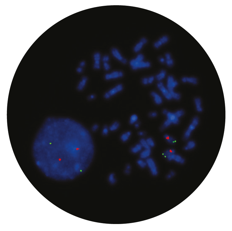 Fluorescence in situ hybridization (FISH) microscope image of the CytoCell Angelman (UBE3A/D15S10) Region probe.