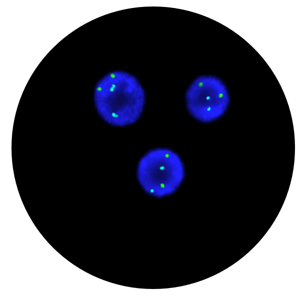 Fluorescence in situ hybridisation (FISH) microscope image of the CytoCell FAST FISH Prenatal X, Y and 18 probe.