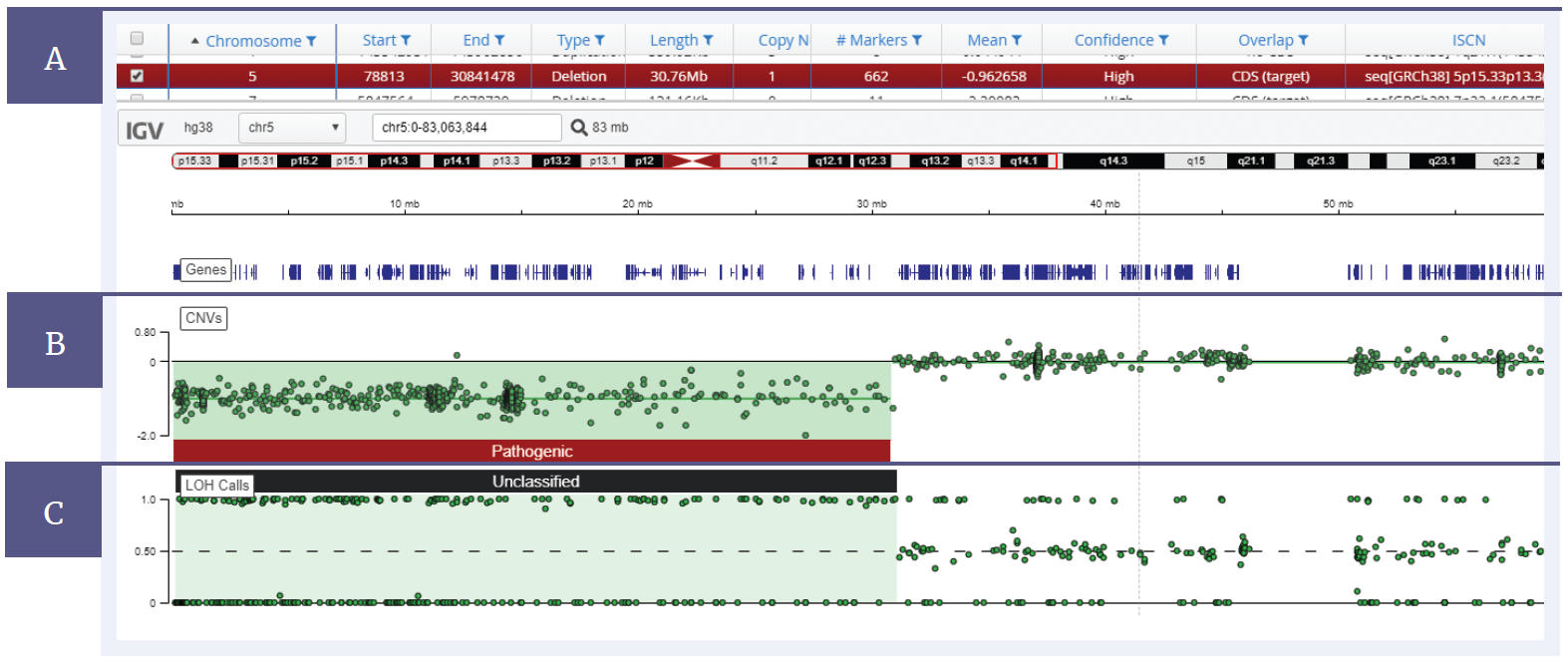 Next generation sequencing (NGS) software data showing a 30 Mb deletion on chromosome 5 and LOH across the deletion.