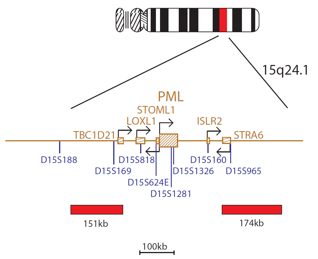 Fluorescence in situ hybridization (FISH) chromosome map showing a probe targeting the PML gene.