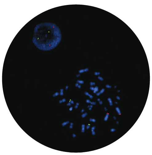Fluorescence in situ hybridisation (FISH) microscope image of the CytoCell IGH/FGFR3 Translocation, Dual Fusion probe.