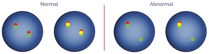 Deletion/fusion probes
