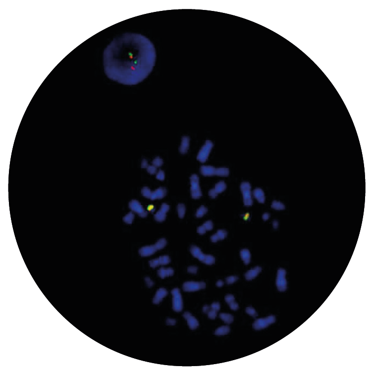 Fluorescence in situ hybridisation (FISH) microscope image of the CytoCell IGL Breakapart probe.
