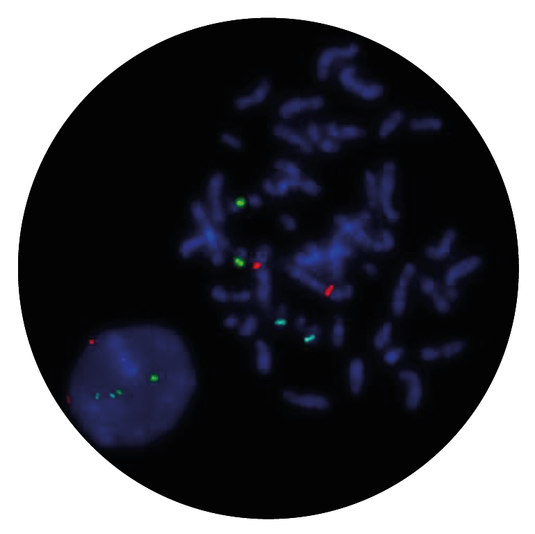 Fluorescence in situ hybridisation (FISH) microscope image of the CytoCell E2A/PBX1 Plus Translocation, Dual Fusion probe.