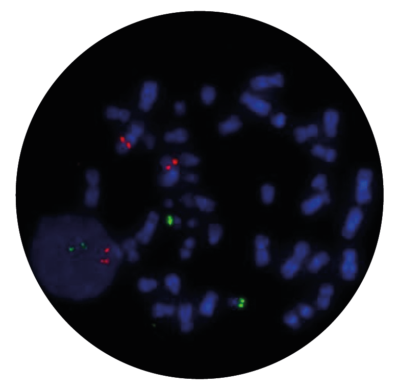 Fluorescence in situ hybridisation (FISH) microscope image of the CytoCell E2A (TCF3)/PBX1 Translocation, Dual Fusion probe.