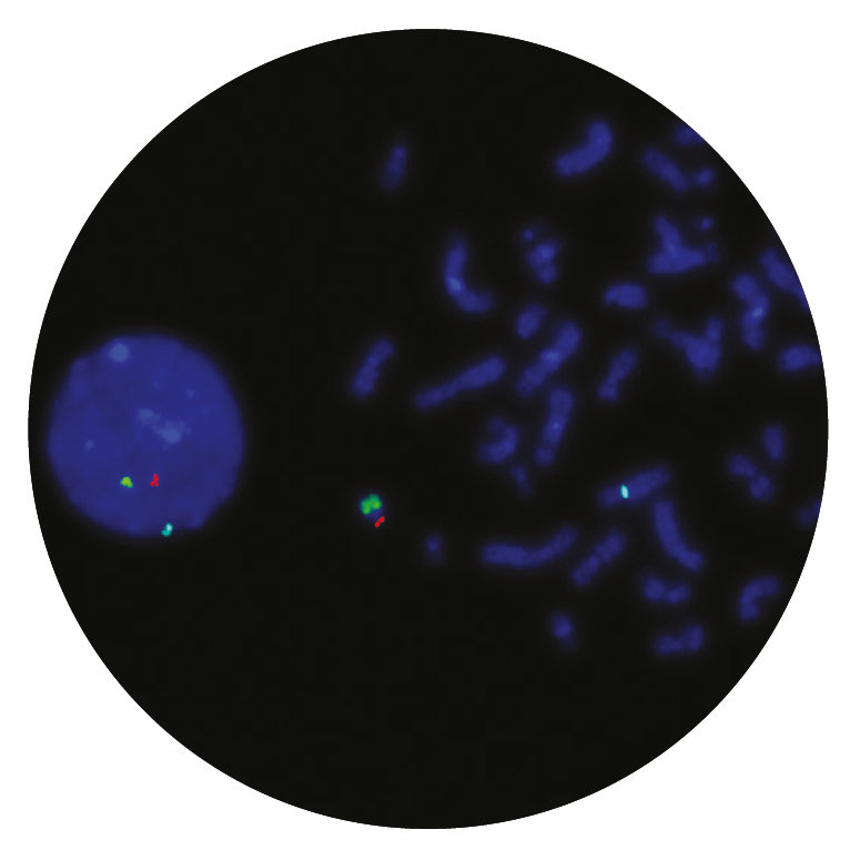 Fluorescence in situ hybridisation (FISH) microscope image of the CytoCell SRY probe.