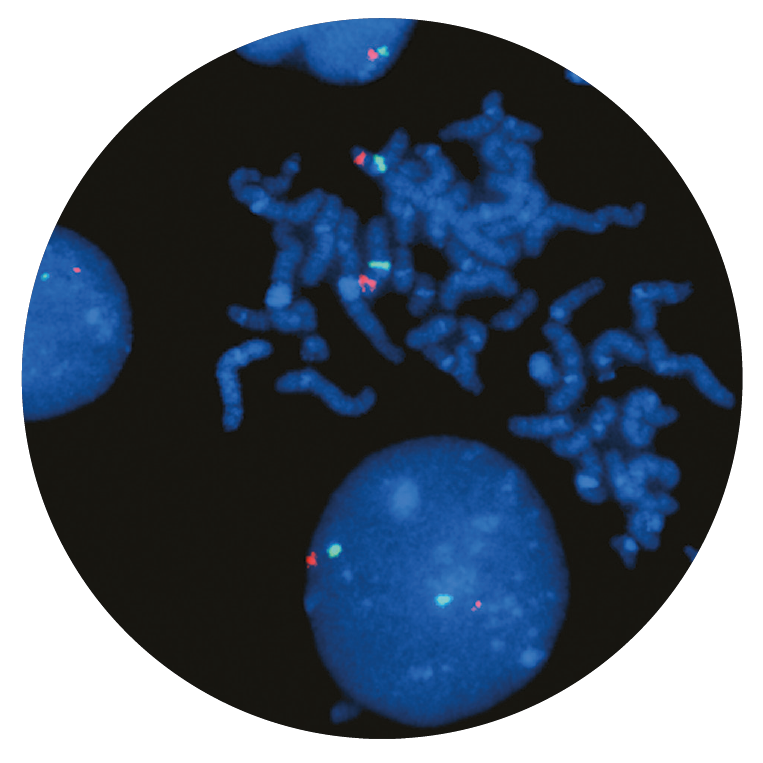Fluorescence in situ hybridization (FISH) microscope image of the CytoCell P16 (CDKN2A) Deletion probe.