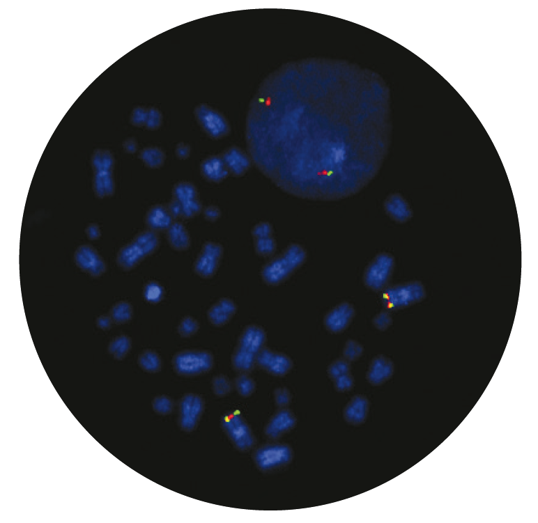Fluorescence in situ hybridization (FISH) microscope image of the CytoCell BCL6 Breakapart probe.
