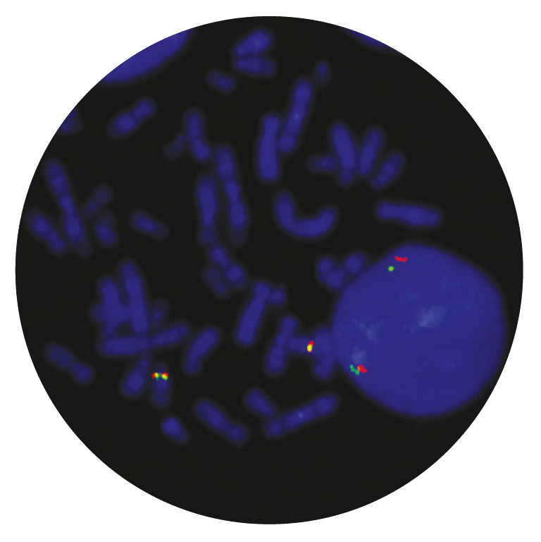 Fluorescence in situ hybridization (FISH) microscope image of the CytoCell TCRAD Breakapart probe.