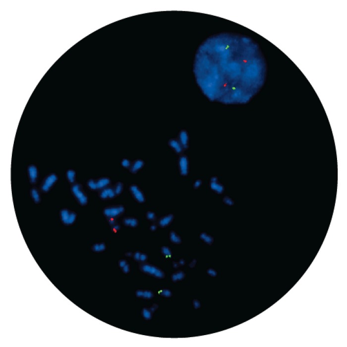 Fluorescence in situ hybridization (FISH) microscope image of the CytoCell IGH/MAFB Translocation, Dual Fusion probe.