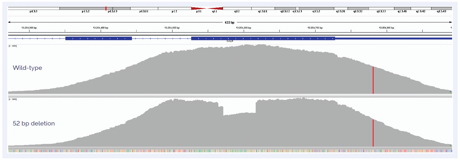 NGS software data showing detection of a 52 bp deletion in exon 9 of CALR compared to a wild type sample.