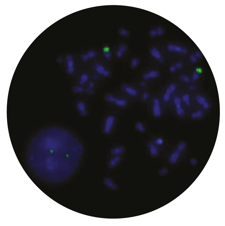 Fluorescence in situ hybridization (FISH) microscope image of the CytoCell IGH Distal Plus probe.
