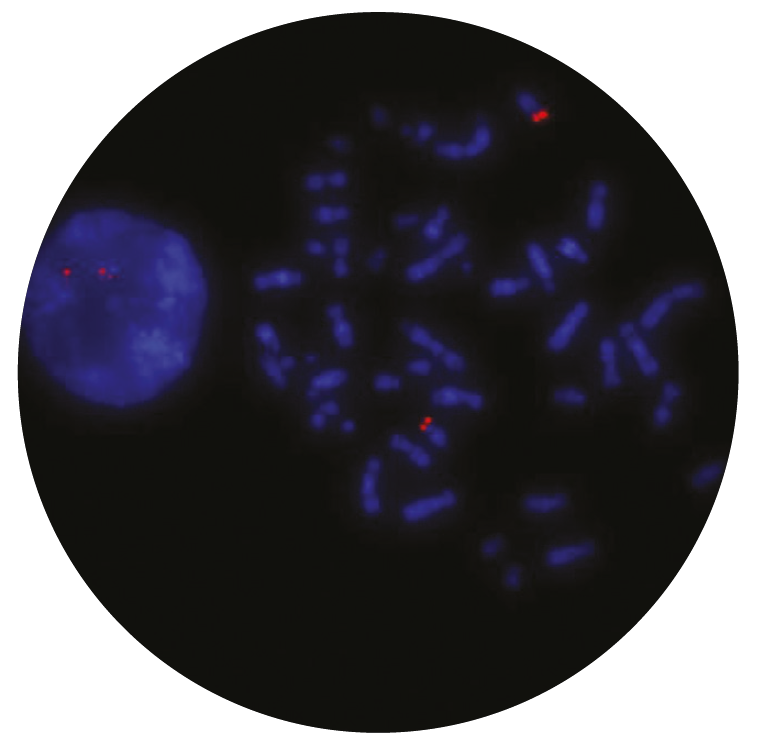 Fluorescence in situ hybridization (FISH) microscope image of the CytoCell IGH Proximal Plus probe.