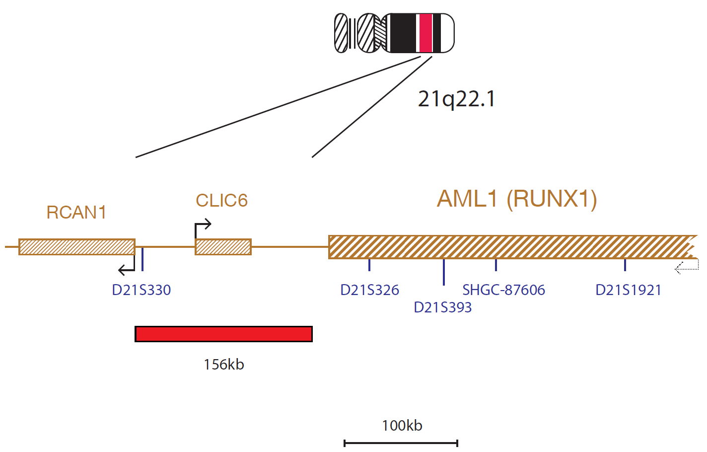 Fluorescence in situ hybridization (FISH) chromosome map showing a probe targeting the AML1 (RUNX1) gene.