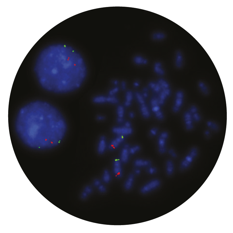 Fluorescence in situ hybridization (FISH) microscope image of the CytoCell Del(5q) Deletion probe.