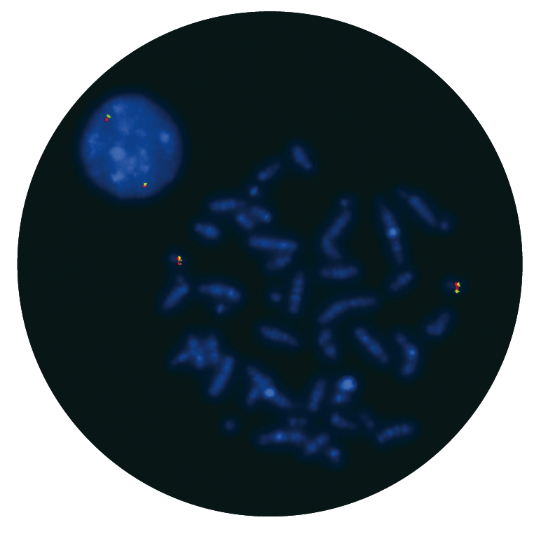 Fluorescence in situ hybridization (FISH) microscope image of the CytoCell Del(20q) Deletion probe.